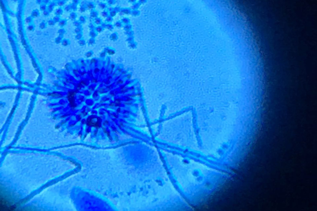 Foto de microscopio con el hongo Aspergillus que invade Señal.
