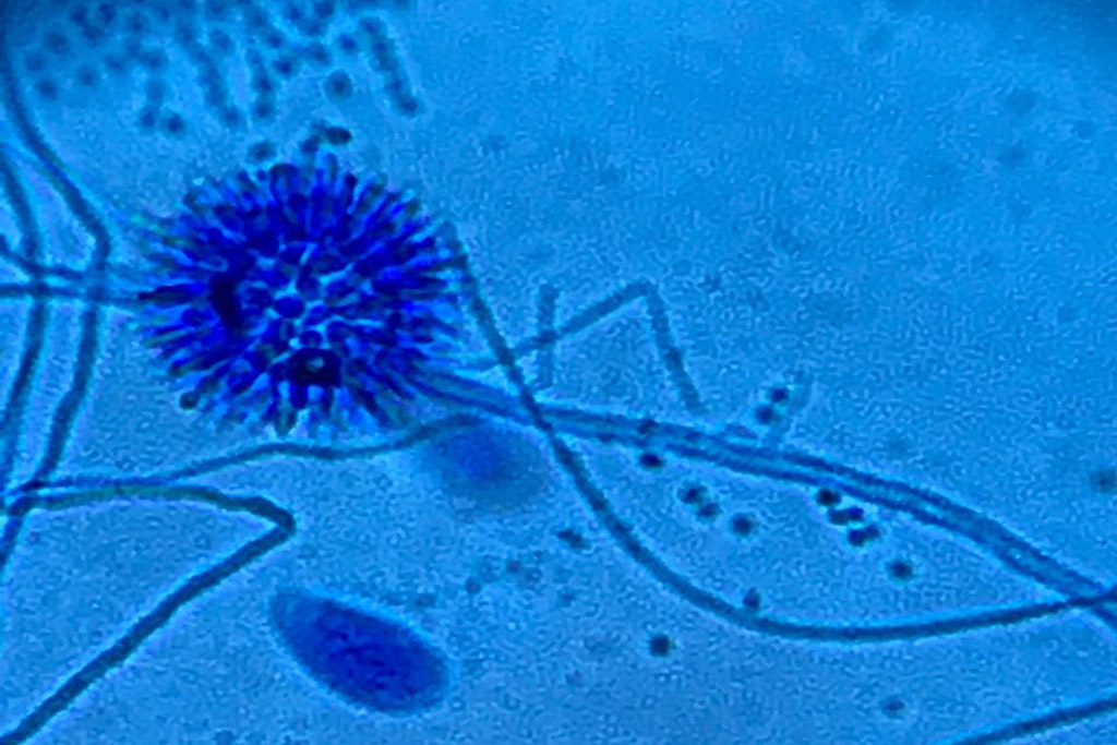 Foto de microscopio con el hongo Aspergillus que invade Señal.